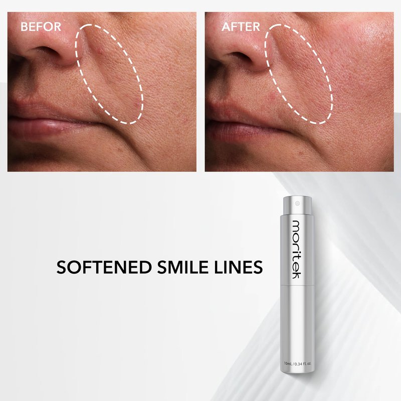 MORITEK Anti-Wrinkle & Lifting Essence Mist for Sensitive, Dry & Aging Skin – to Firm, Hydrate, Brighten and Visibly Reduce Wrinkles | Can be used over makeup |10ml