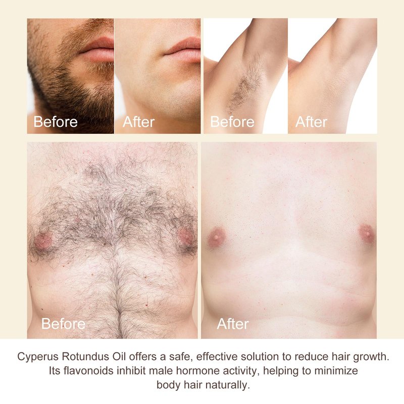 Cyprus Rotundus Oil for Hair Removal - Reducing Body Hair Growth | 100% Pure Cyperus Rotundus Essential Oil for Smooth Skin & Hair Removal, 60ml