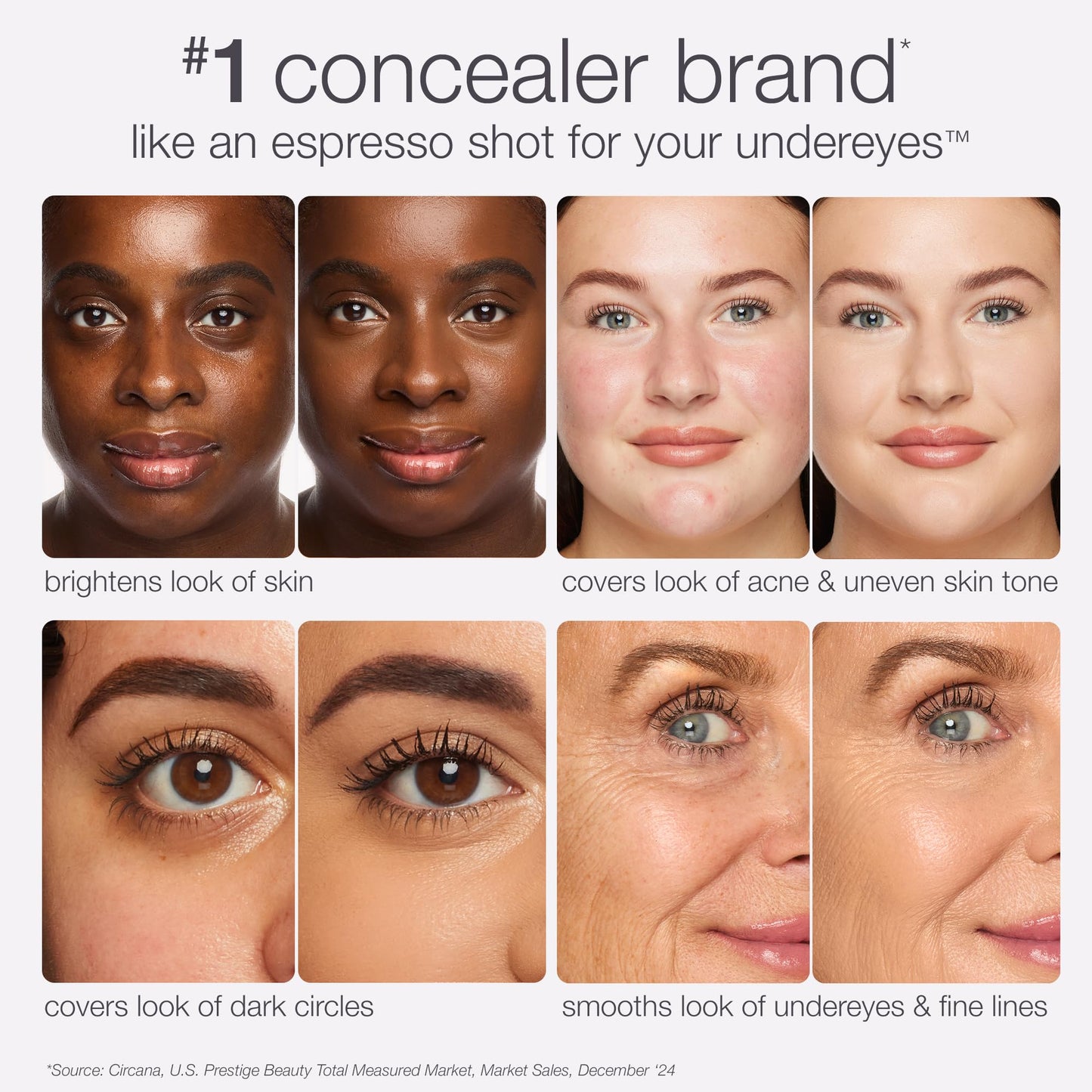 tarte shape tape creamy concealer – Full Coverage Makeup with Built-In Eye Cream, 24HR Hydrating Natural Moisturizing Matte Finish for Redness & Fine Lines, Vegan & Cruelty-Free, full size, 20B