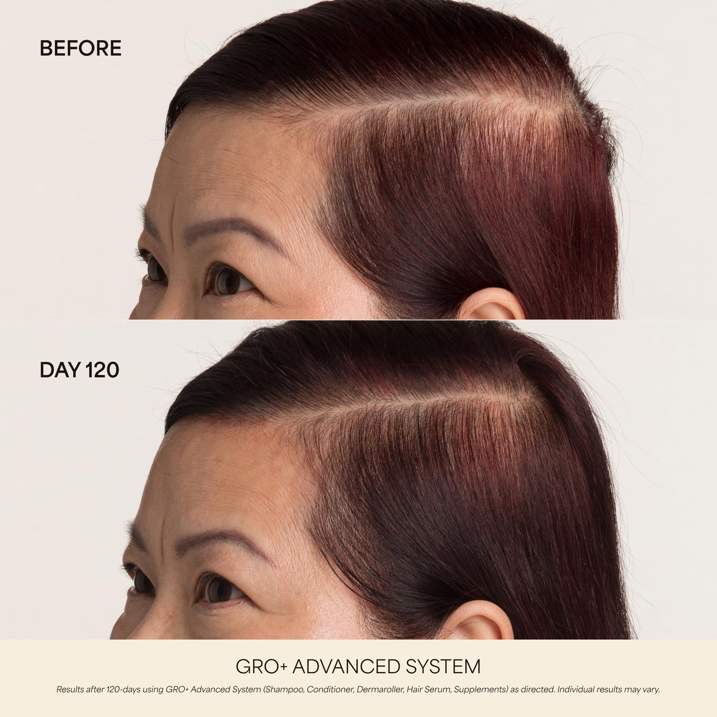VEGAMOUR GRO+ Advanced Hair Growth Vitamin Supplements - Boosts Hair Growth & Density - 30 Pill Packs/Box