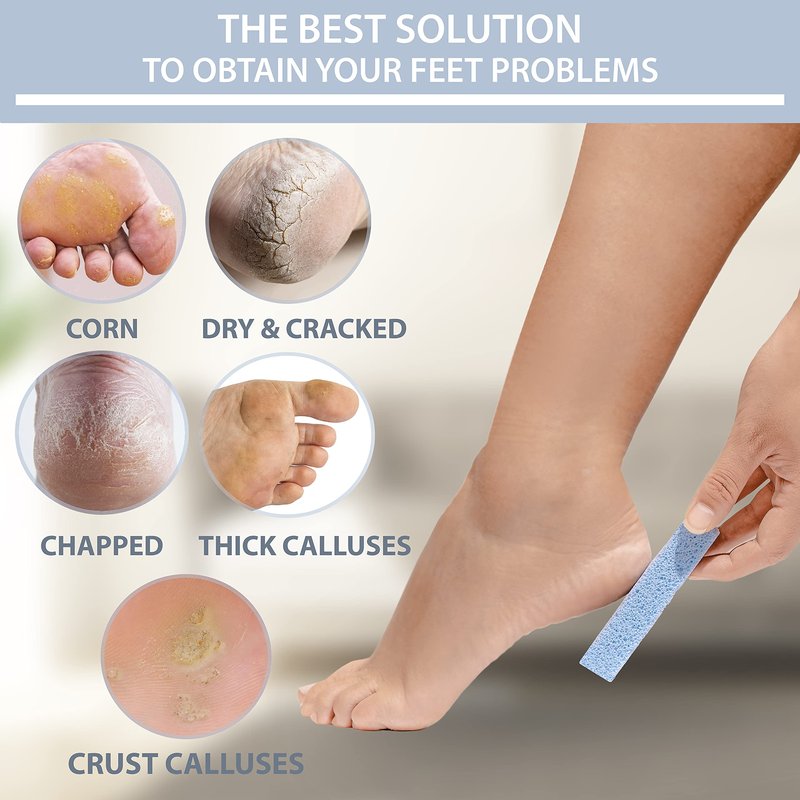 Artist Land Pumice Stone for Feet – 3 Pack Foot Scrubber Dead Skin Remover – Spain Made Glass Pumice Stone for Hard Skin and Foot Callus Remover – Exfoliating Foot Scrubber