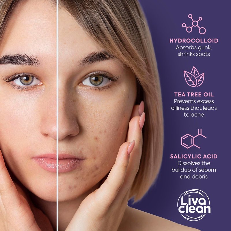 Livaclean 240CT Star Pimple Patches for Face w/ Hydrocolloid, Tea Tree oil & Salicylic Acid - Zit Stickers, Hydrocolloid Acne Patches for Face - Cute Pimple Patch, Acne Stickers