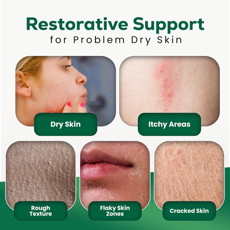 Renucell Restorative Healing Ointment for Itchy and Dry Skin with Natural PHYOXOLIN® – Moisture Barrier Skin Repair Cream to Soothe Cracked, Irritated Skin on Face & Body 2.5 oz
