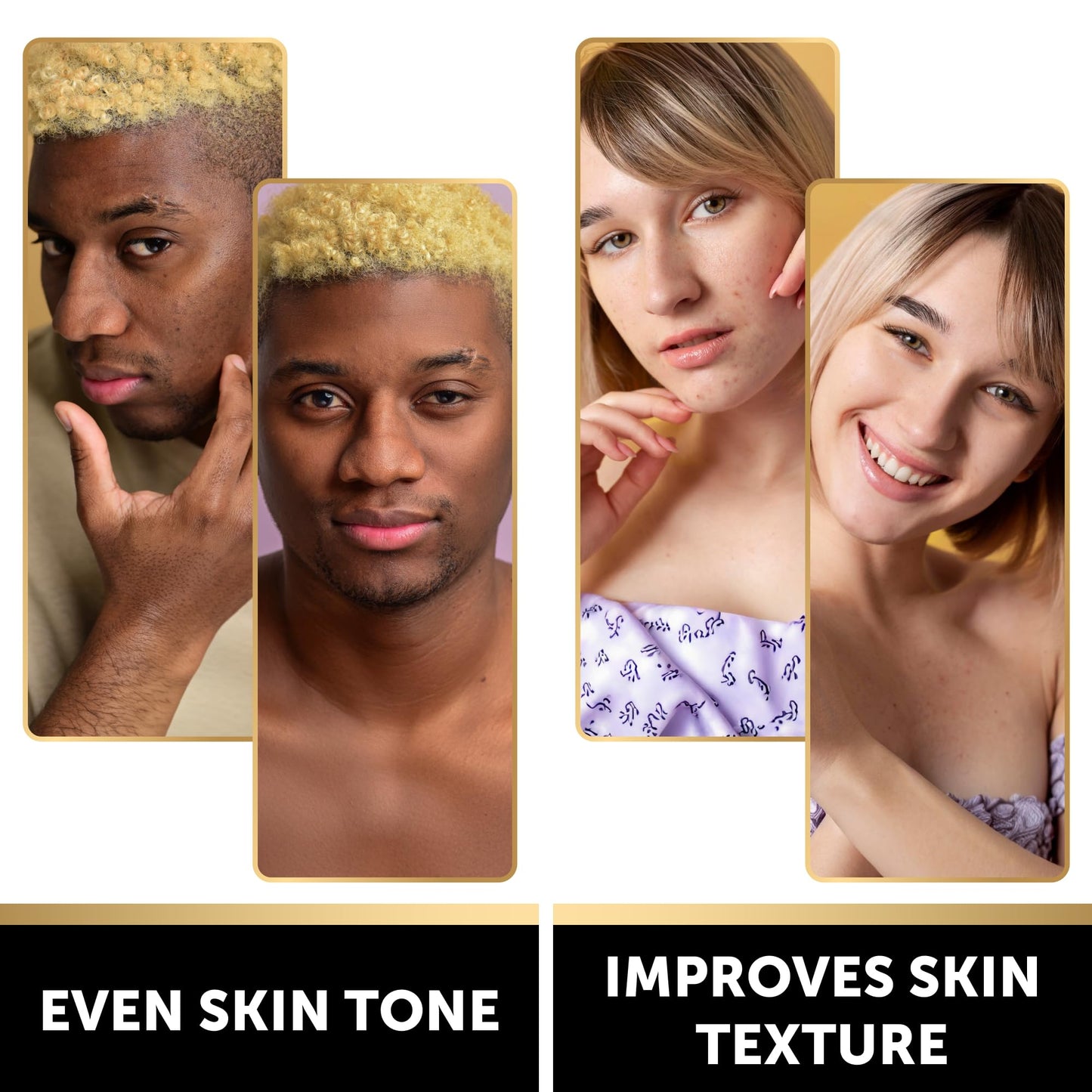VALITIC Kojic Acid Soap - Turmeric Soap for Dark Spots for Face and Body - Exfoliating Bar for Hyperpigmentation, Skin Tone Corrector with Retinol, Vitamin C, Collagen and Hyaluronic Acid - 1 Pack