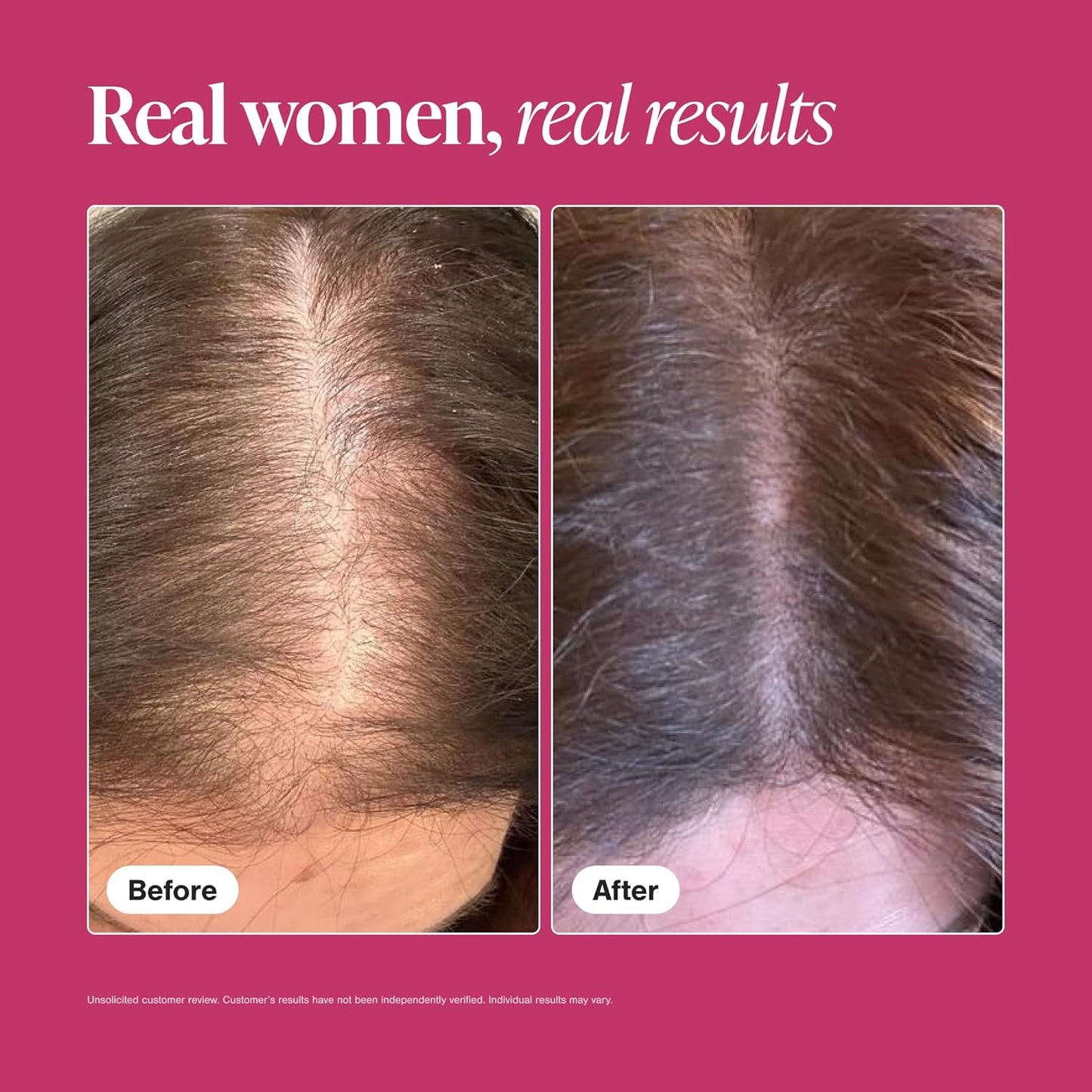 Viviscal Hair Growth Supplements for Women - Thicker, Fuller Hair Support with Biotin & Marine Collagen | 180 Tablets, 90-Day Supply