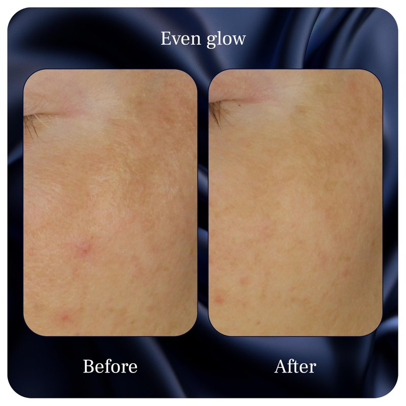 Even Glow - Organic Vitamin C Serum for Dark Spots on Face - Dark Spot Corrector, Dark Spot Remover for Face & Body - with Kakadu Plum Extract, Maple Leaf Extract, Aloe Leaf Juice & More - 1 Fl Oz