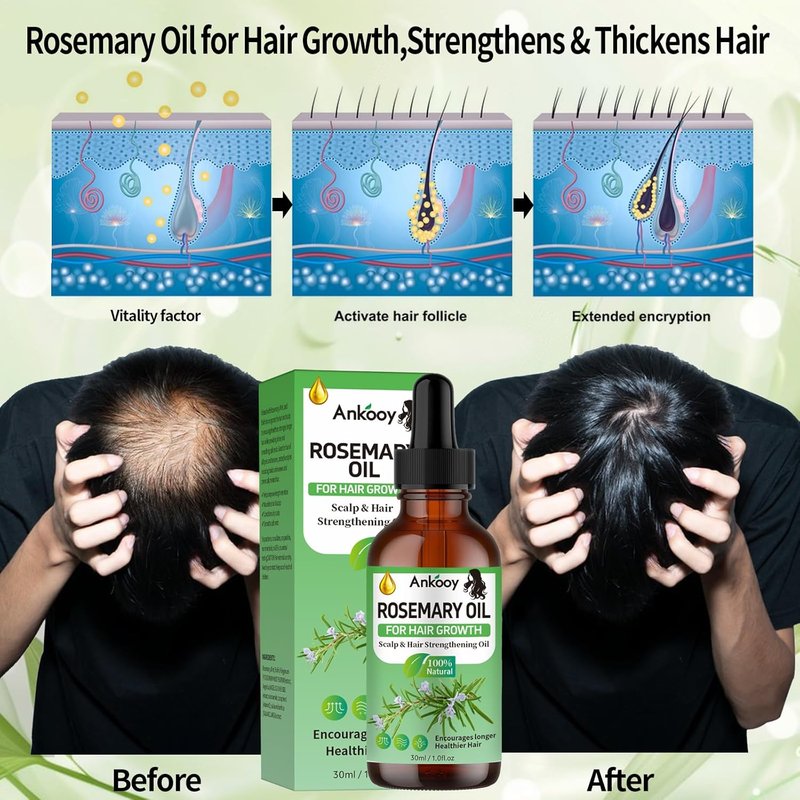 Rosemary Oil for Hair Growth - Strengthening Treatment for Dry, Damaged Hair | 3 Pack