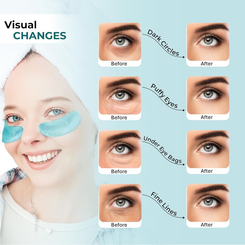 24K Gold Under Eye Masks - Collagen & Hyaluronic Acid Gel Patches for Dark Circles & Puffiness | 20 Pairs