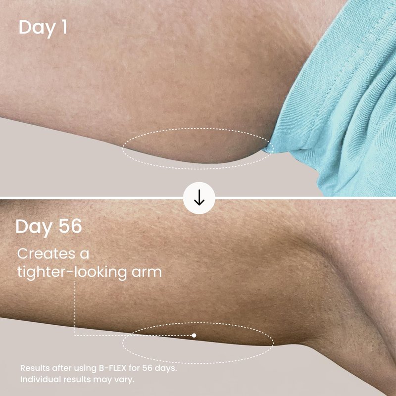 MAËLYS B-FLEX Arm Firming Cream - Skin Tightening Cream for Loose Skin & Crepey Skin - Helps Look of Aging and Sagging Skin - Arm Toning Cream - Red Algae & Kangaroo Flower (3.4 Fl Oz)