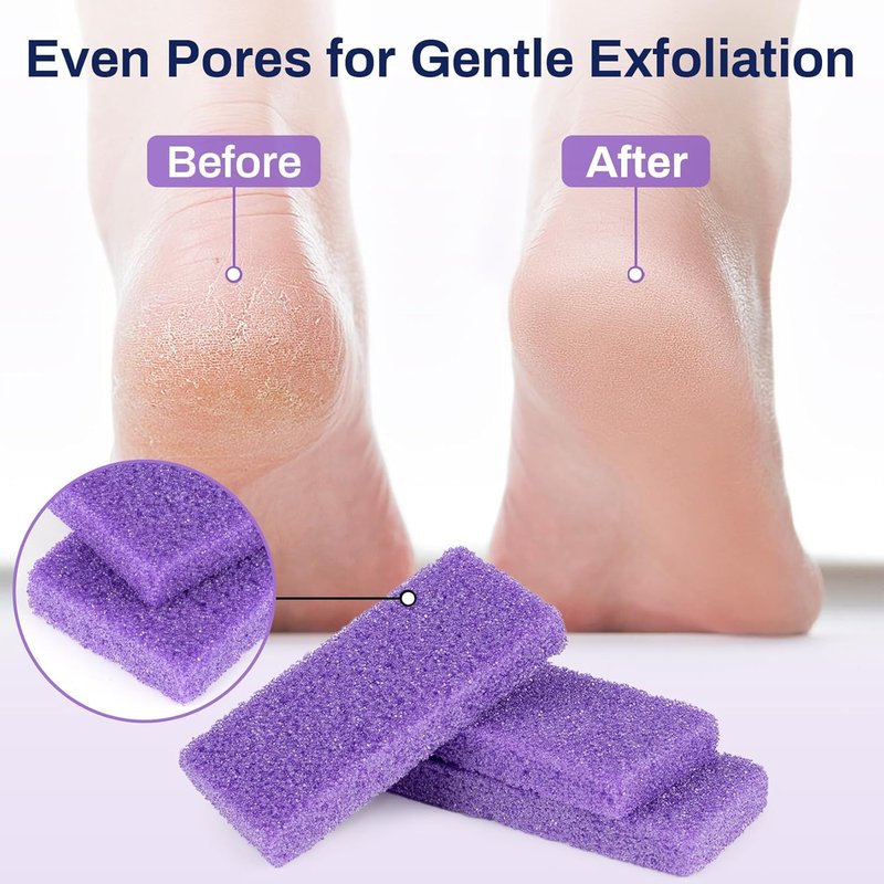Pumice Stone for Feet - 20 Pack Purple Foot File for Callus Removal | 3.6 x 1.8 x 0.47 Inch Exfoliating Scrubber