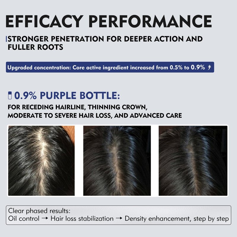 KINTOR 0.9% KX-826 DHT Blocker for Men & Women Hair Growth,Hair Growth Products Spray 60ml Pro