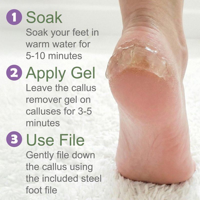 Dr. Entre's Callus Remover Gel & Foot File: Extra Strength Callus Remover for Feet, Foot Callus Remover Care, Pedicure Tools Supplies, Spa Kit, Dead Skin Scrubber, 4 oz