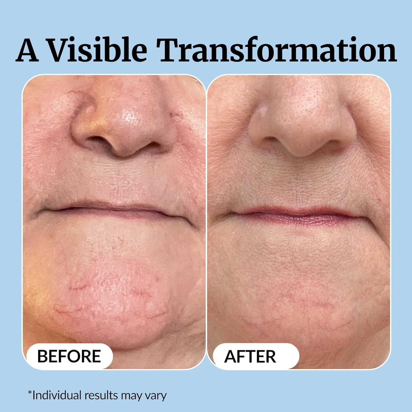 Vibriance Super C Serum for Mature Skin - All-in-One Vitamin Formula for Hydration, Firmness & Wrinkle Reduction | 1 fl oz