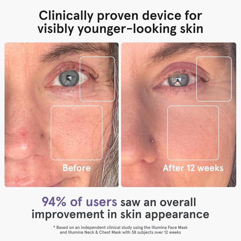 iRestore LED Face Mask - Youthful Skin Red Light Therapy | 360 LEDs for Wrinkles & Dark Spots