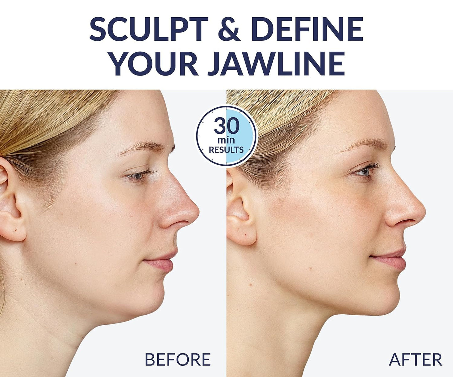 Stylia V Line Lifting Collagen Mask - Firm & Contour Jawline - Hyaluronic Acid & Aloe - 10 Pack