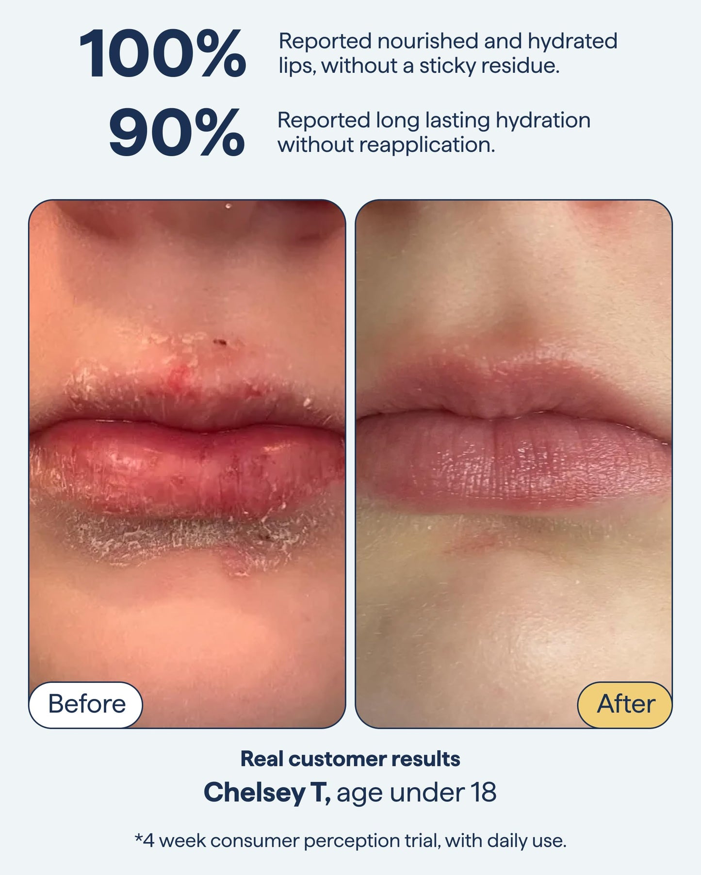 Remedy for Dry Lips | All-In-One Lip Treatment | Hydrating and Healing Lip Balm Ointment with Ceramides, Peptides, and Dimethicone | Repairs Dry, Cracked Lips | By Dermatologist Dr. Shah