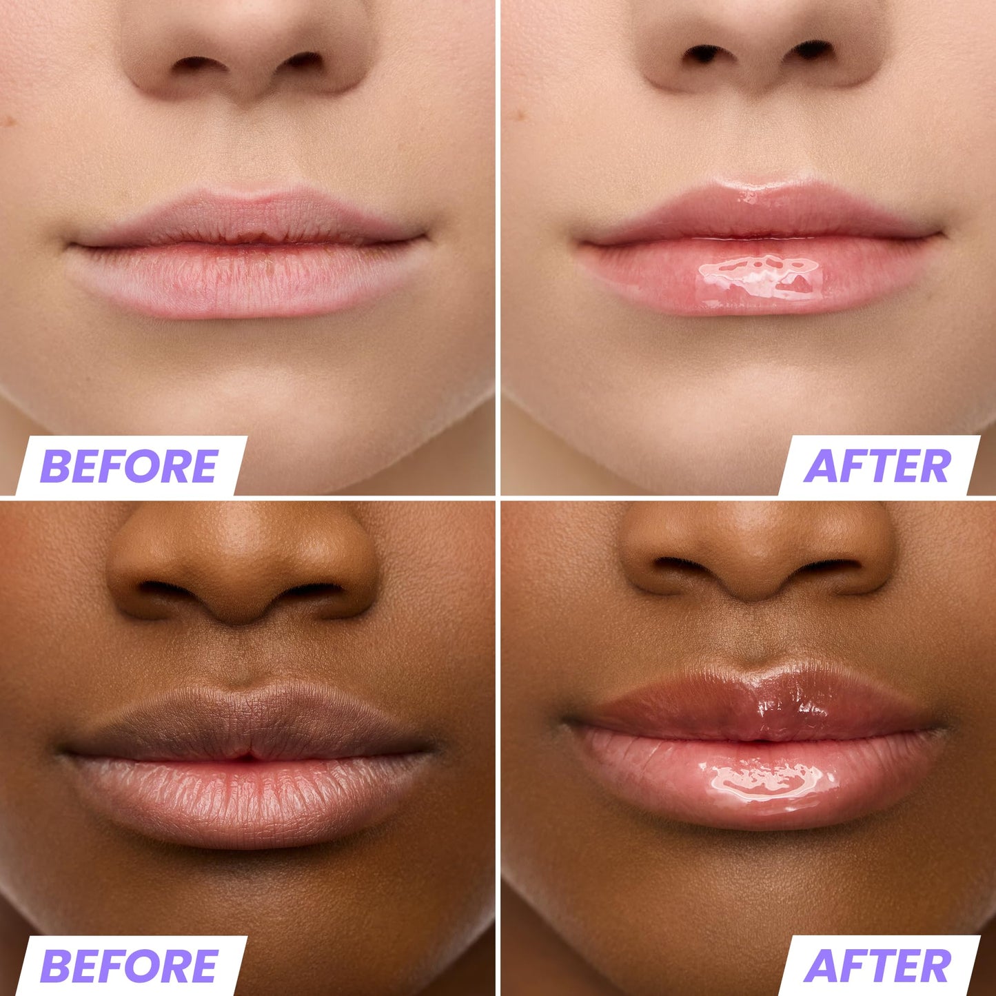 Wonderskin Lip Oil Rehab Serum - Tinted Lip Oil, Hydrating, Moisturizing, and Non-Sticky Coral Pink Tint Serum for Dry Lips (Lover)