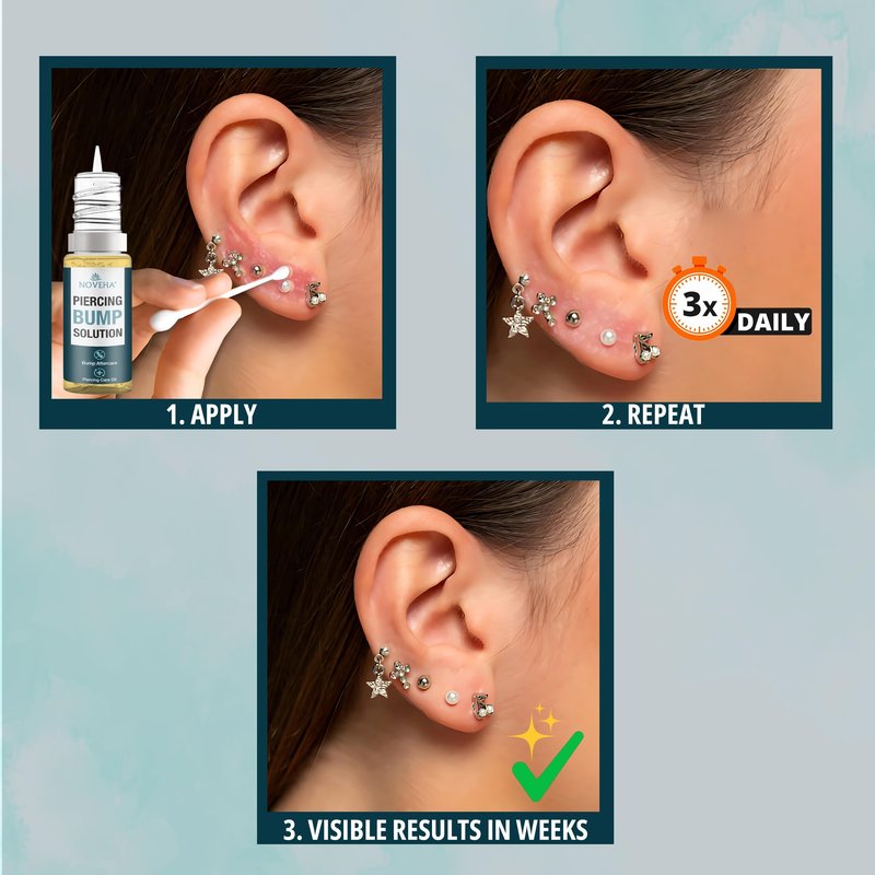 NOVEHA Piercing Bump Solution 20ml for Keloid Reduction | Soothing Solution Tea Tree Oil Formula for Scars & Keloid Bump Removal | Safe & Natural Piercing Aftercare Skin Recovery for Face & Body