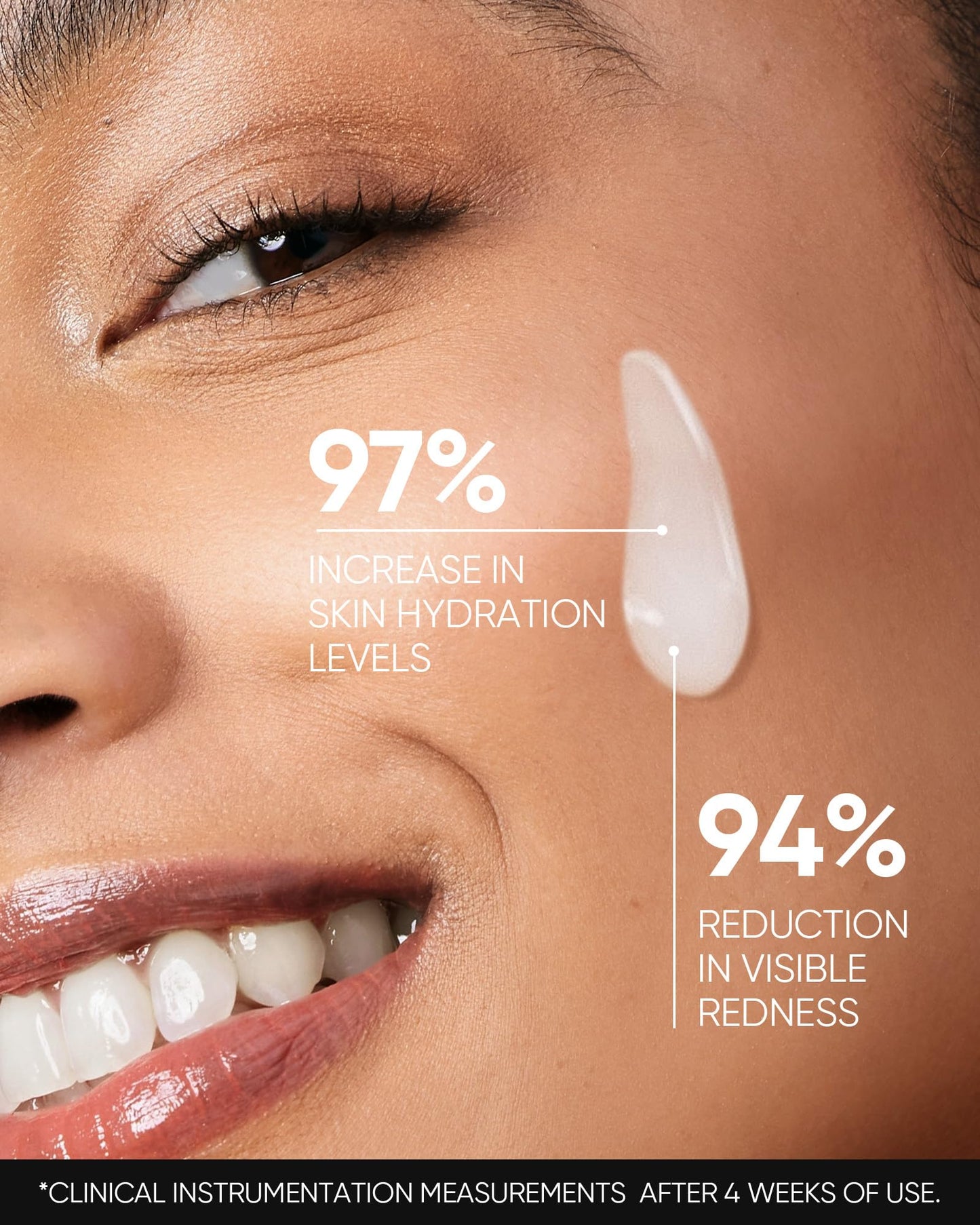 SKINTIFIC 5X Ceramide Barrier Repair Serum for Dry & Sensitive Skin Barrier Repair with Ceramide, Centella and Hyaluronic Acidx, Soothes Sensitive Skin, Reduces Redness & Strengthens Skin Barrier