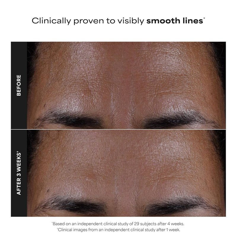 Paula's Choice Skin Perfecting 2% BHA Liquid Exfoliant - Salicylic Acid Facial Polish for Pores & Fine Lines | Fragrance-Free