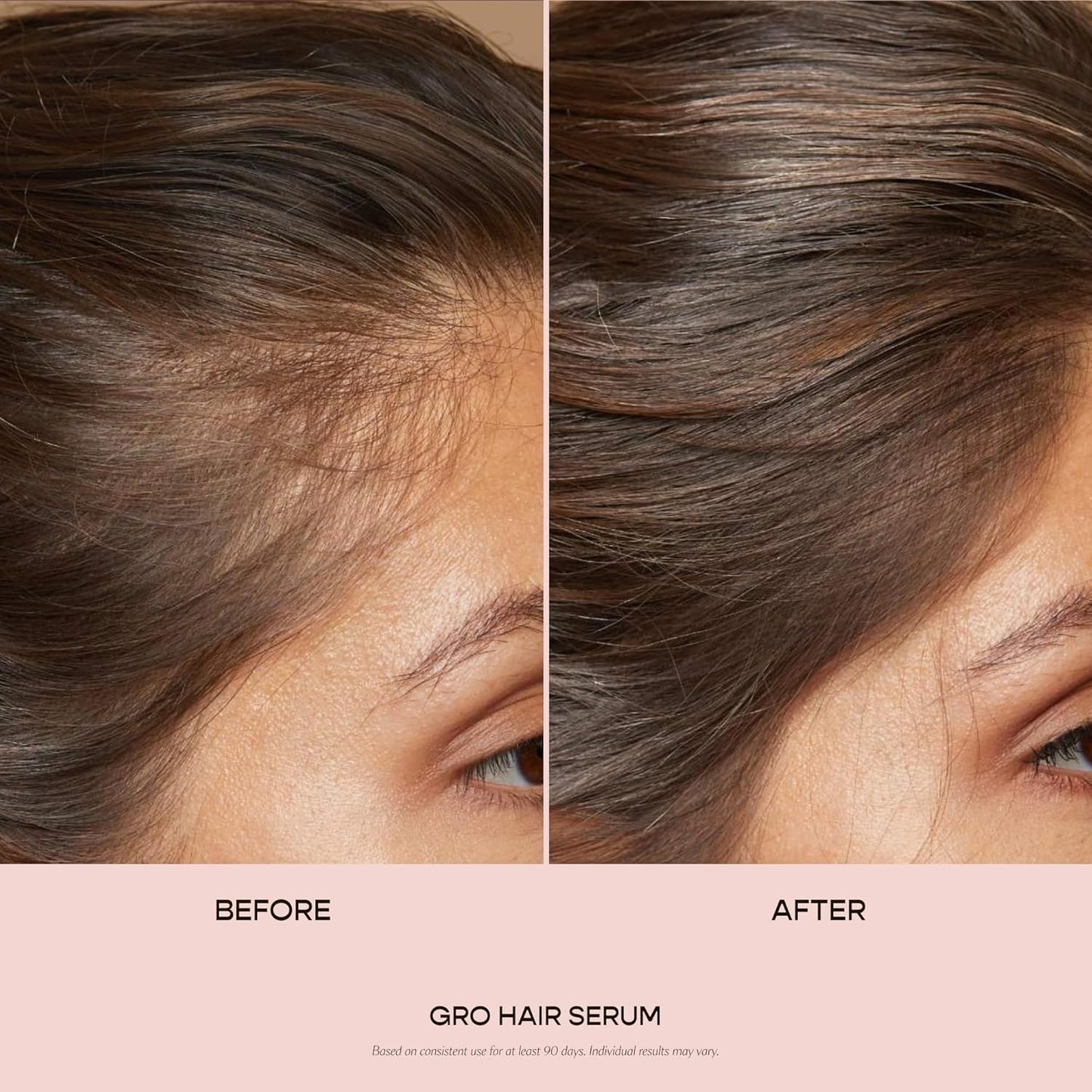 VEGAMOUR GRO Hair Serum - Thicker, Fuller Hair in 90 Days | Non-Oily, Vegan, Bergamot Scent
