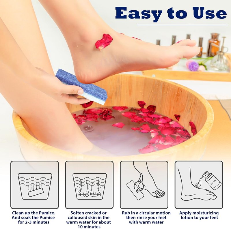 EWAGOA Foot Pumice Stone Set - 6 Pack Callus Remover & Exfoliator for Smooth Feet | Blue