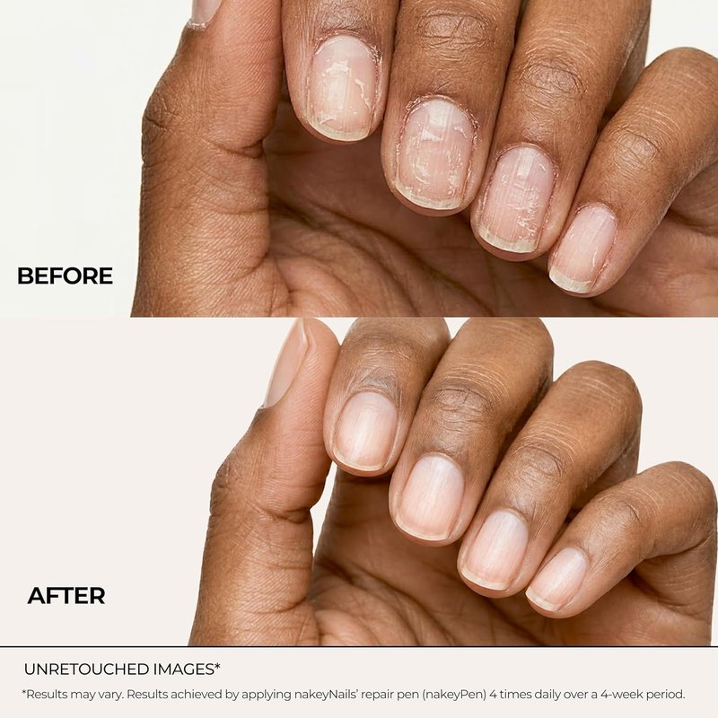 NakeyNails Nail Strengthening Serum - Fast Absorbing Treatment for Damaged & Brittle Nails | 45-Day Supply with Keratin, Peptides & Hyaluronic Acid