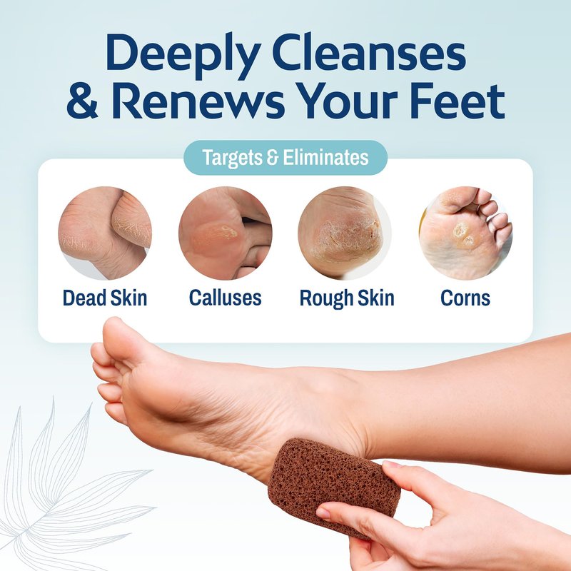 Hartfelt Magic Pumice Stone for Feet Callus Removal | Easy to Use Foot Scrubbing Stone for Removing Dead Skin from Heels, Toes, and Feet | Chemical-Free Foot Exfoliator - Pedicure Essential