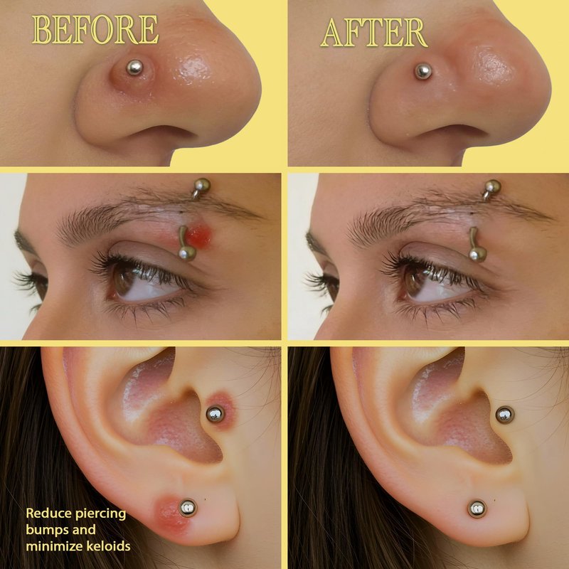 BodyJ4You Piercing Aftercare Kit - Saline Spray for Piercings Wound Wash - Keloid Bump Removal Treatment Oil - Ear Piercing Cleaner Nose Septum Belly Button Cartilage - Natural Saline Solution Set