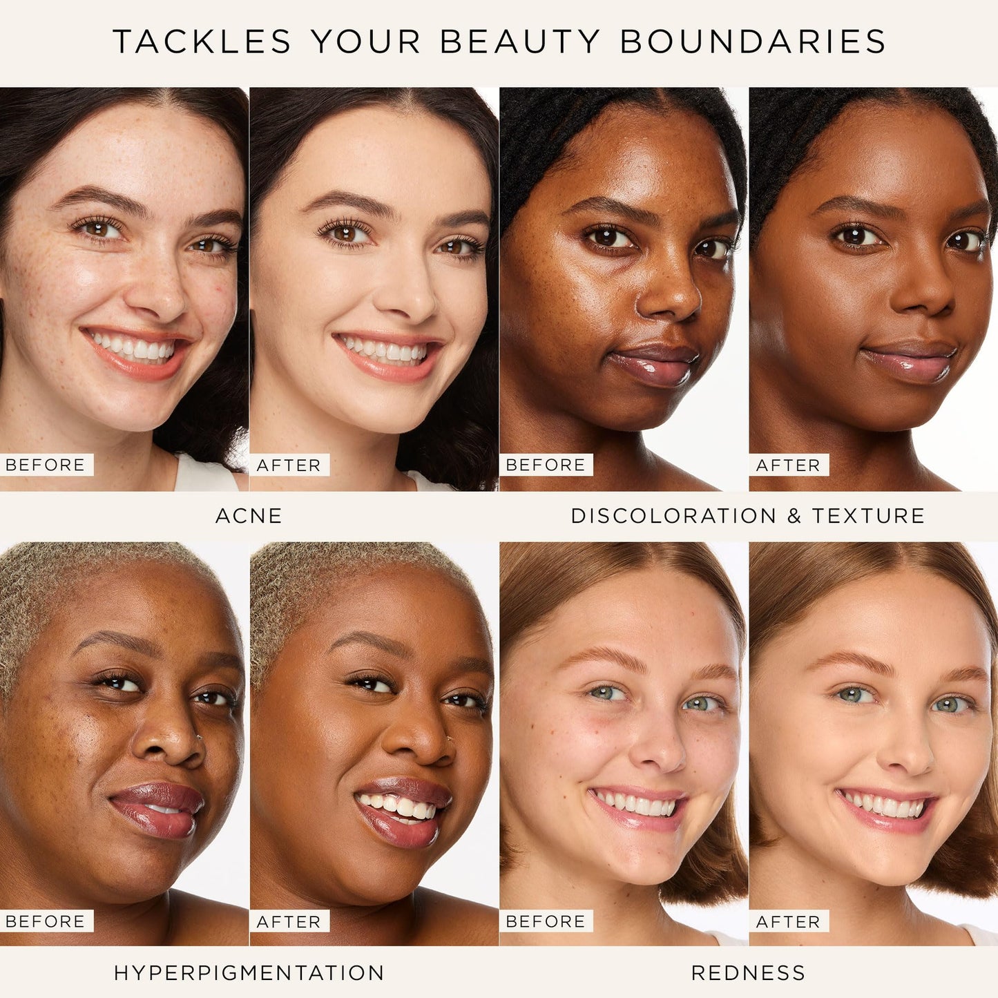 tarte shape tape concealer & brush – Instant Full Coverage for Under Eye, Dark Circles, Redness & Discoloration, Dermatologist-Tested, Vegan, Cruelty-Free, full size, 29N light-medium