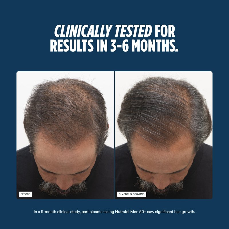 Nutrafol Men 50+ Hair Growth Supplements, Clinically Tested for Visibly Thicker Hair and Scalp Coverage, #1 Dermatologist-Recommended Hair Growth Supplement Brand - 1 Month Supply