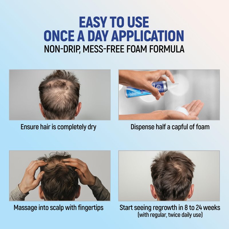 Minoxidil 5% Topical Aerosol Foam, Hair Regrowth 4 Months Treatment for Men, 2.11 oz (4 Pack)