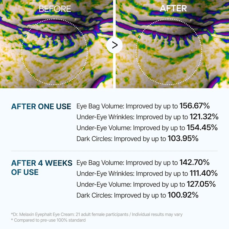 Dr. Melaxin EyePhalt Eyebag Cream - Reduces Puffiness & Dark Circles | 10ml Size