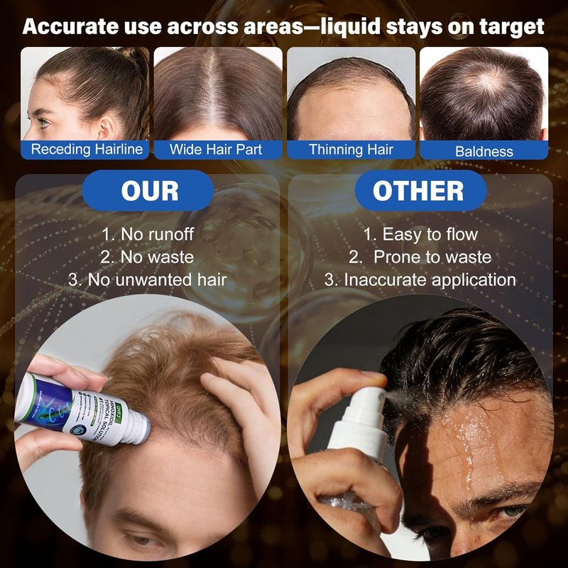 Minoxidil Hair Growth Serum - 5% Formula for Men & Women | Biotin-Infused, 8-Month Supply (6 x 2.7 FL OZ)