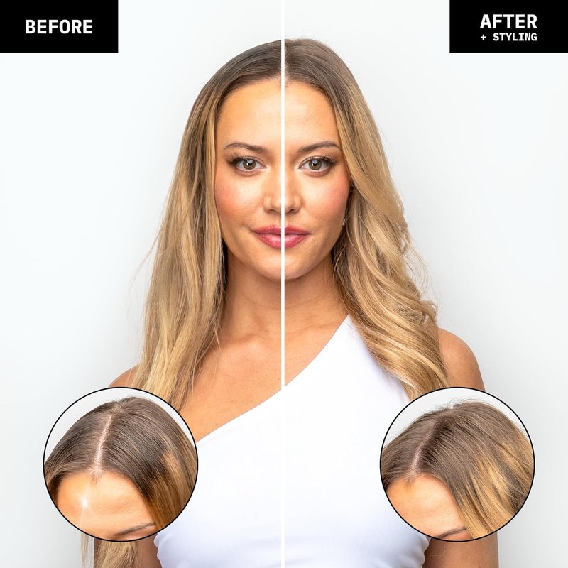 FoxyBae Overnight Dry Shampoo Spray - Biotin & Charcoal Formula for Oily Hair | 7 fl oz