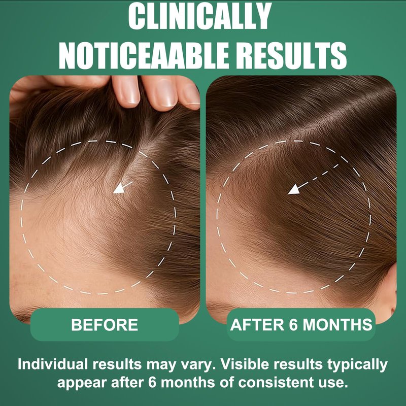 5% Minoxidil for Men - Minoxidil for Women Hair Growth Treatment Beard Growth Serum,Biotin & Rosemary to Fight Hair Loss, Strengthens Weak Roots, Repairs Thinning Hair