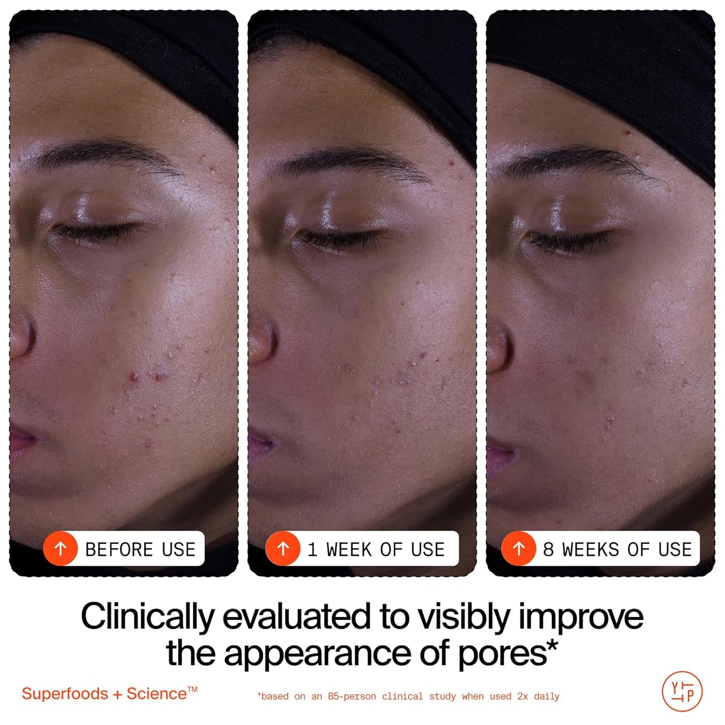 Youth To The People Superfruit Facial Cleanser - Gentle Exfoliating Face Wash with Papaya & Vitamin C for Radiant Skin, Sulfate-Free