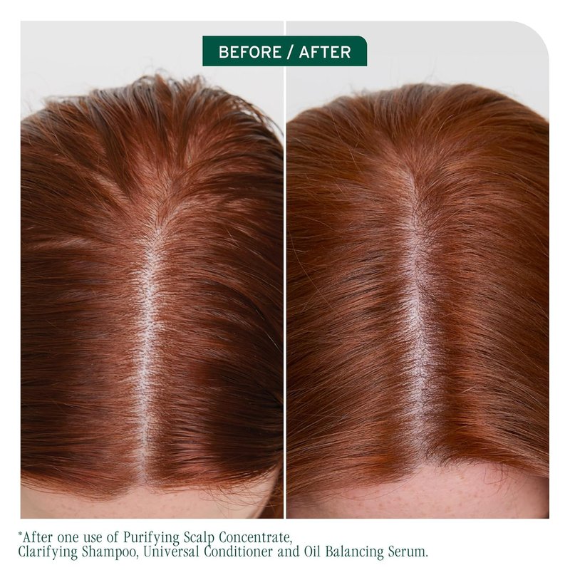 Biolage Scalp Sync Clarifying Shampoo - Oily Scalp Residue & Buildup Remover | 13.5 Fl Oz