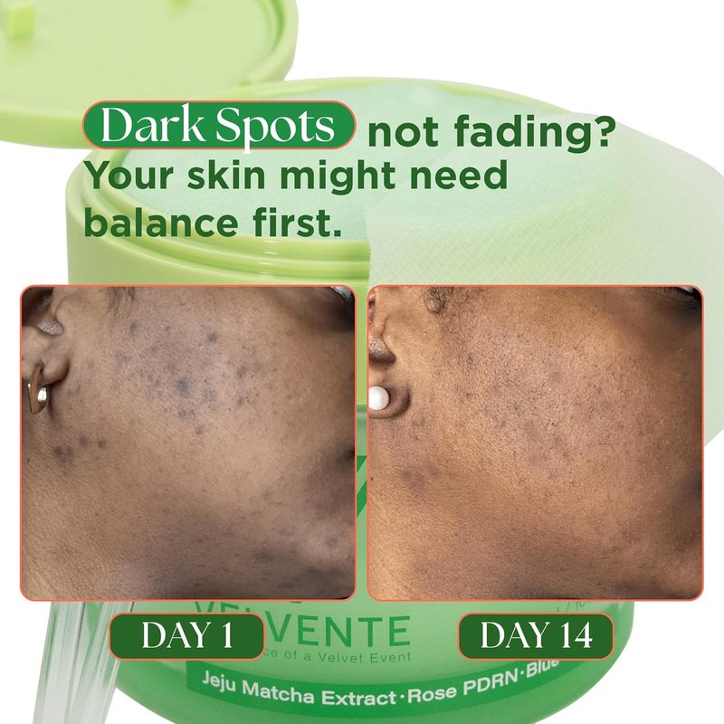 Skiennix Matcha Facial Moisturizer - Hydrating Rose PDRN Cream for Anti-Aging & Radiance | 3.53 oz