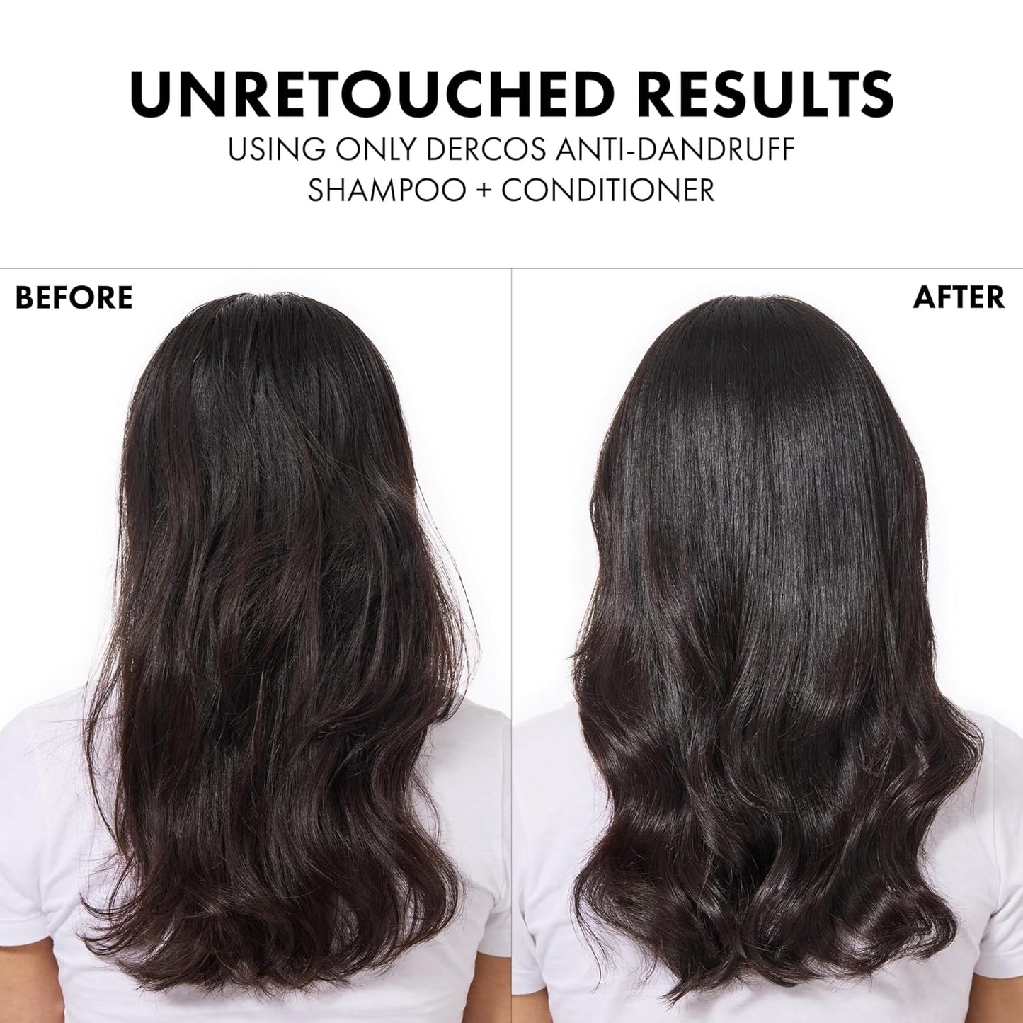Vichy Dercos Dandruff Shampoo, Antifungal Itchy Scalp Treatment for Men & Women, Clinical Strength Selenium Sulfide, Formulated with Niacinamide & Salicylic Acid, Color Safe, Dermatologist Recommended