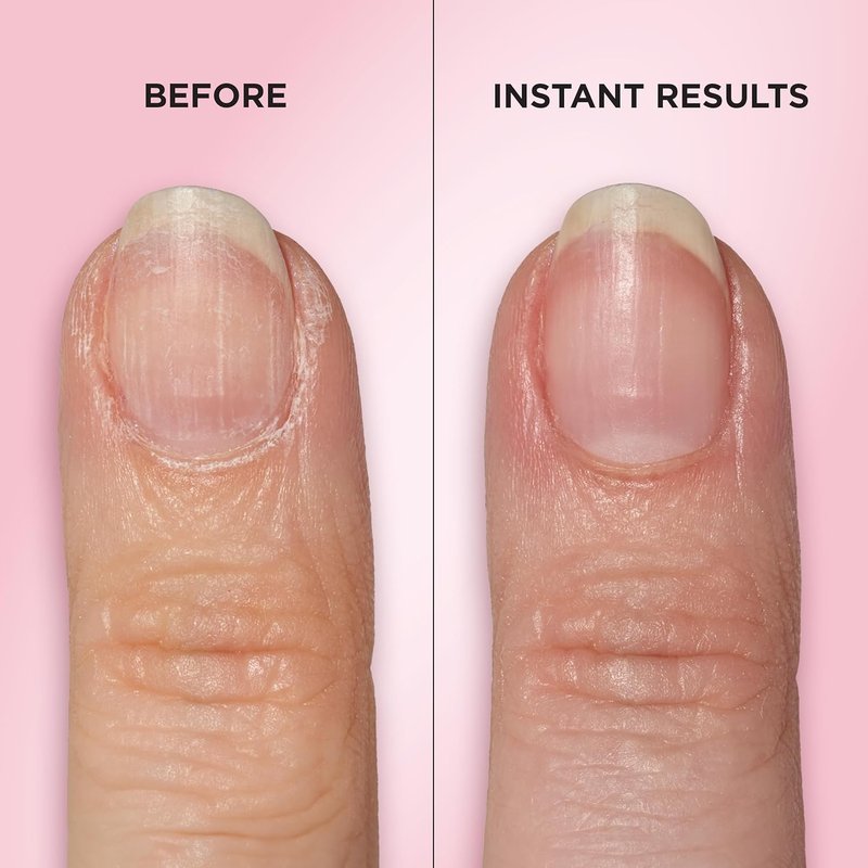 Sally Hansen Cuticle Care Treatment Pen - 2-in-1 Exfoliates & Polishes | Textured Tip for Mess-Free Nail Care