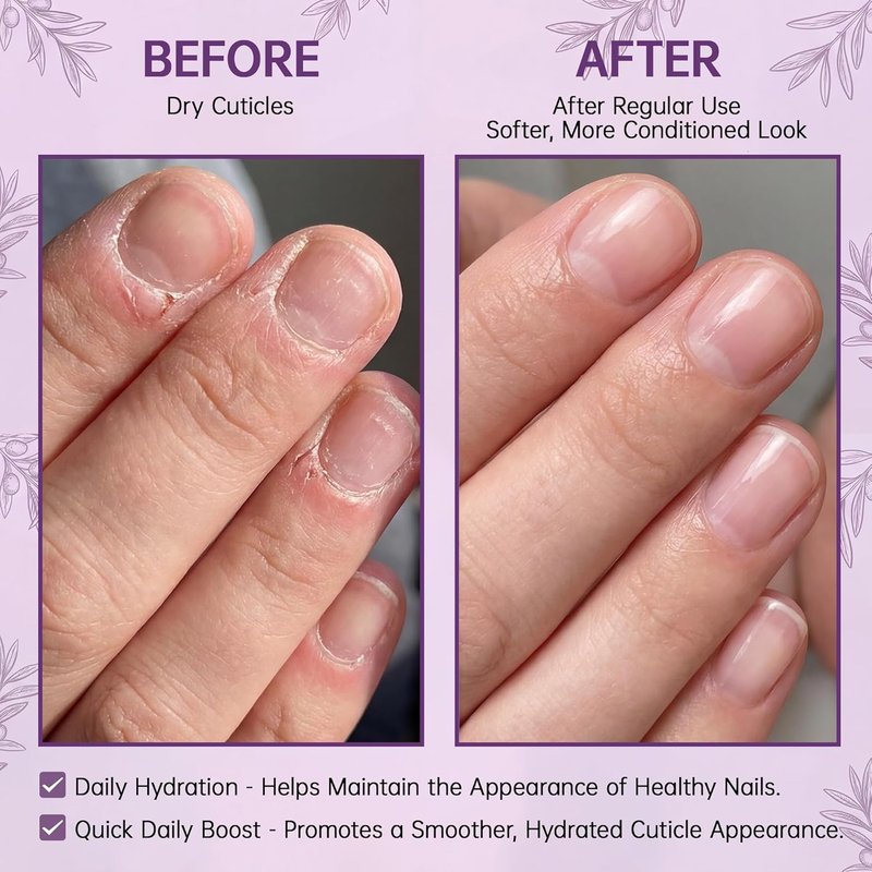 Regine Switzerland Cuticle Oil Pen - Hydrating Nail Moisturizer with Jojoba Oil & Vitamin E, 15ml