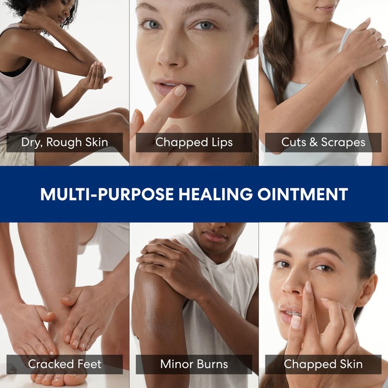 Palmer's Cocoa Butter Formula Healing Ointment with Vitamin E, 3.75 Oz, Intensive Therapy for Severely Dry, Eczema Prone Skin, Provides 48-Hour Moisture, Non-Comedogenic, Dermatologist Approved