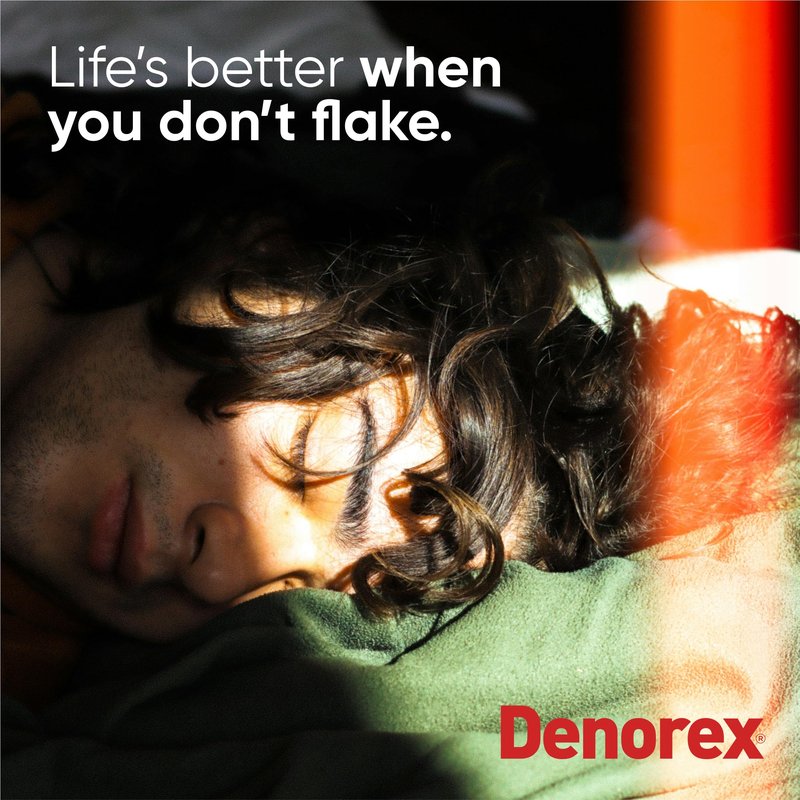 Denorex Extra Strength Multi-Symptom Anti Dandruff Shampoo & Conditioner Treatment, 3% Salicylic Acid Helps Relieve Moderate Symptoms of Dandruff, Seborrheic Dermatitis & Psoriasis, 10oz