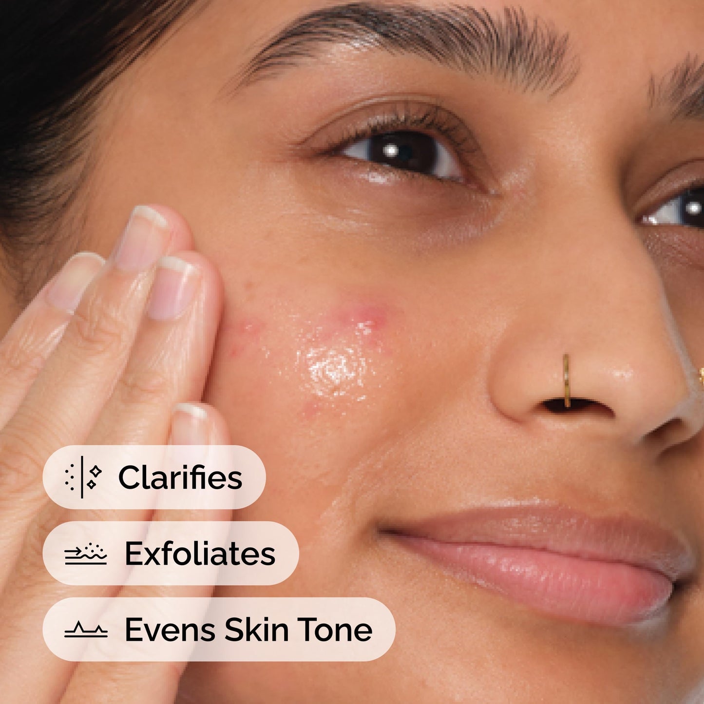 The Ordinary Salicylic Acid 2% Anhydrous Solution, Gentle Exfoliating Serum for Blemish-Prone Skin and Uneven Texture, 1 Fl Oz