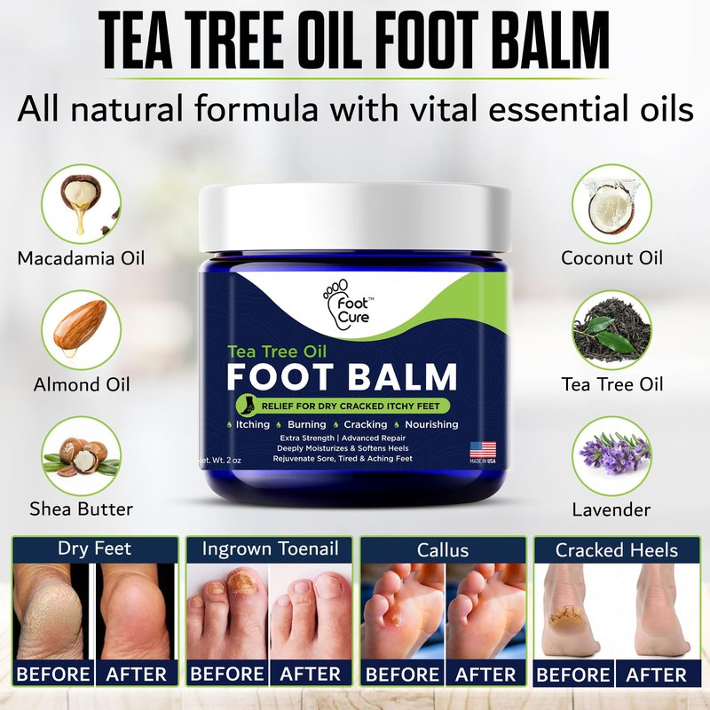 Antifungal Cream - For Itchy Feet and Skin Fungus Relief - Extra Strength Treatment for Athlete’s Foot, Ringworm, and Jock Itch. Moisturizer for Dry Cracked Feet infused with Tea Tree Oil Made in USA
