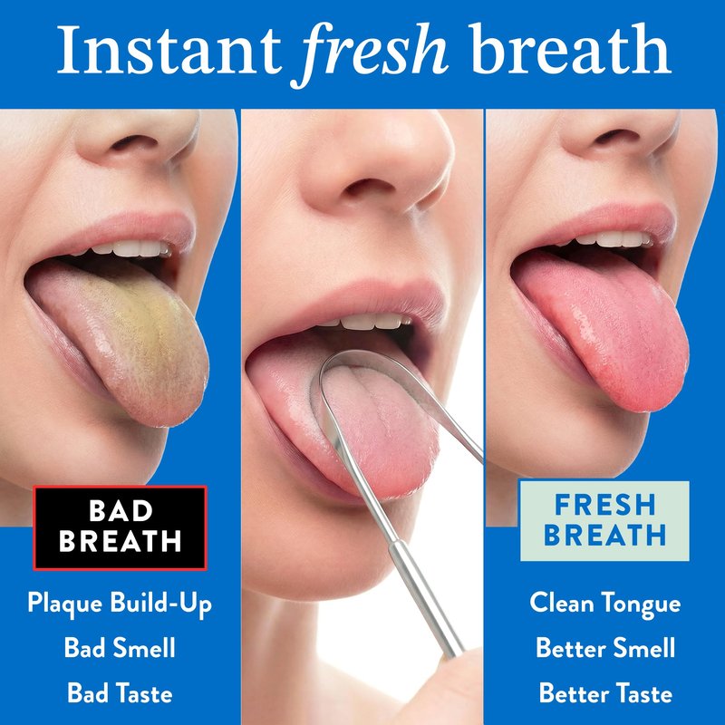 Mouthology Tongue Scraper (2 Pack), Reduce Bad Breath (Travel Cases Included), Stainless Steel Tongue Cleaners, Metal Tongue Scraper, Tongue Scraper for Adults - Fresher Breath in Seconds