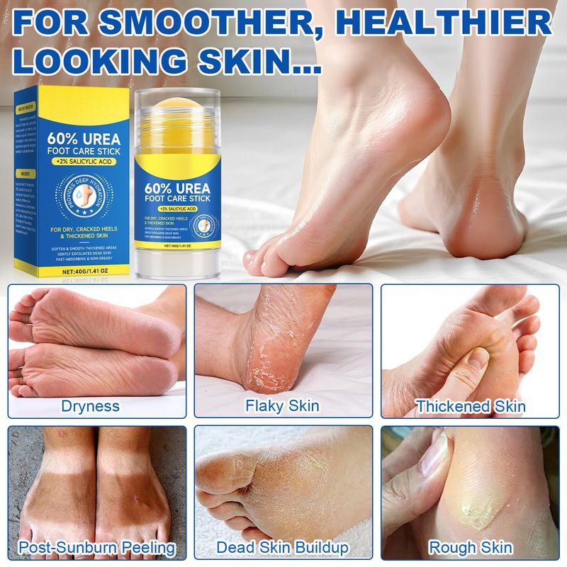60% Urea Cream Stick with 2% Salicylic Acid, Maximum Strength Foot Cream Stick for Dry Cracked Heels & Calluses, Rapidly Softens Thick Skin - Non-Greasy & Fast Acting - 2-Day Visible Results