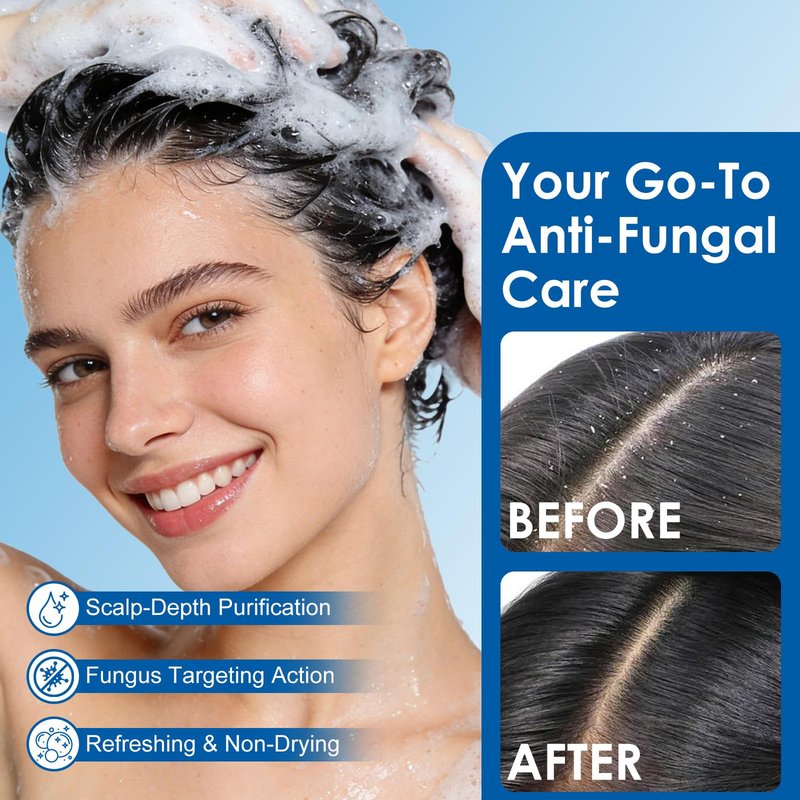 EIUQH Antifungal Shampoo for Seborrheic Dermatitis, Folliculitis, Scalp Psoriasis, Sulfate & Paraben-Free, Anti-Dandruff Formula for Itching, Dryness, and Scalp Relief for Men and Women, 10.14 FL OZ