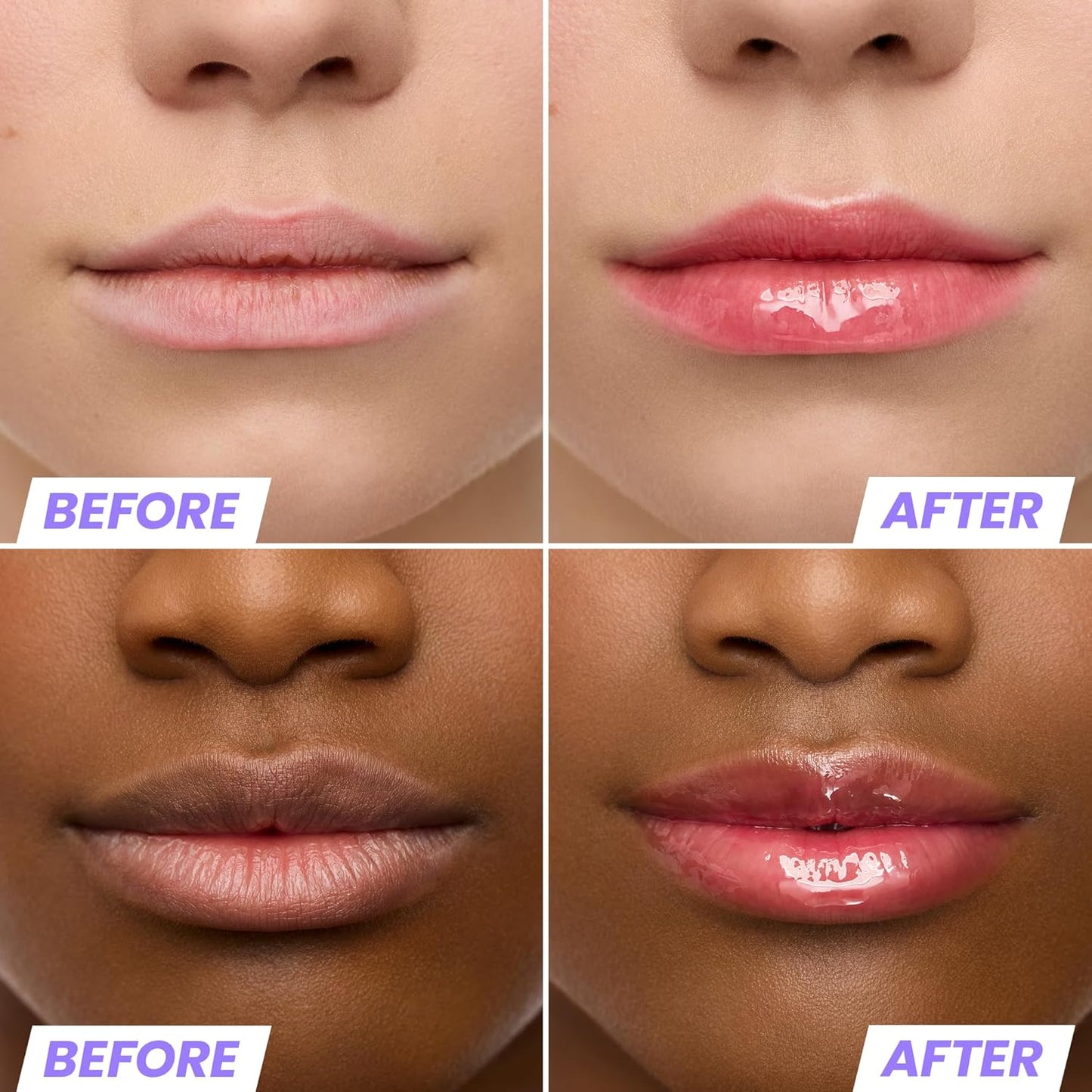 Wonderskin Tinted Lip Oil Rehab Serum - Hydrating, Non-Sticky Red Tint for Dry Lips | Moisturizing Formula